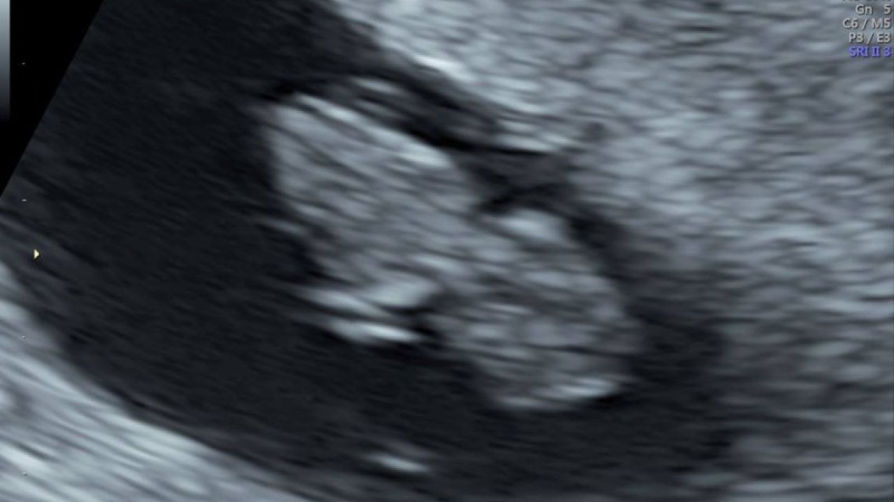 Baby Montoya #5