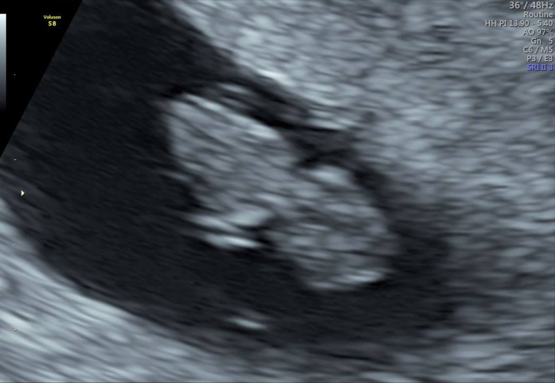 Baby Montoya #5